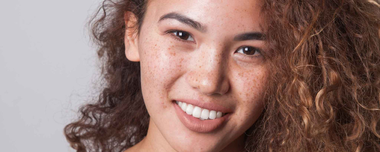 Freckle-face young woman