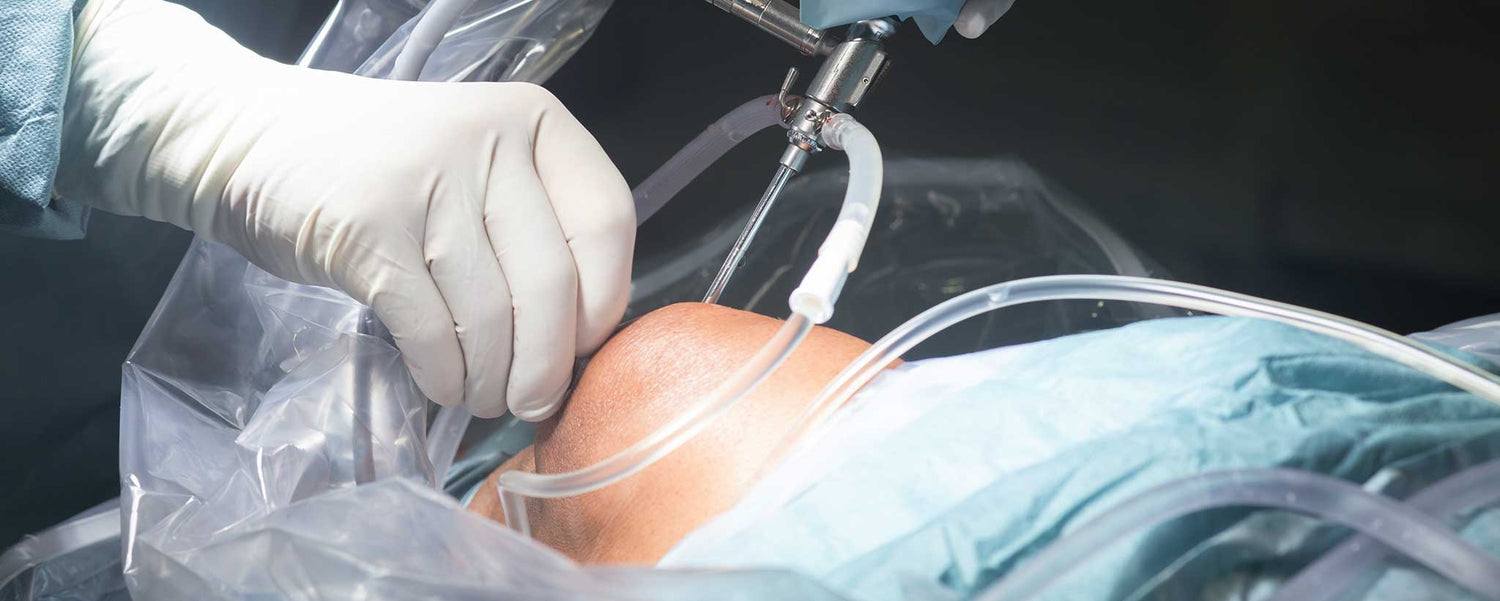 Alternatives to Knee Replacement