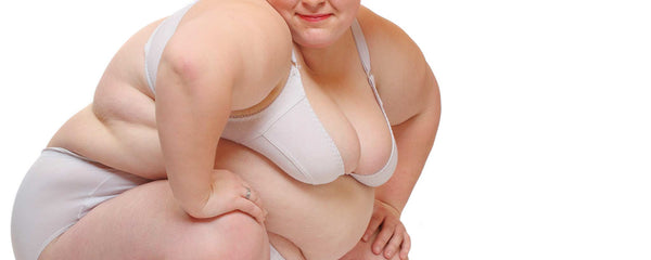 Obese woman