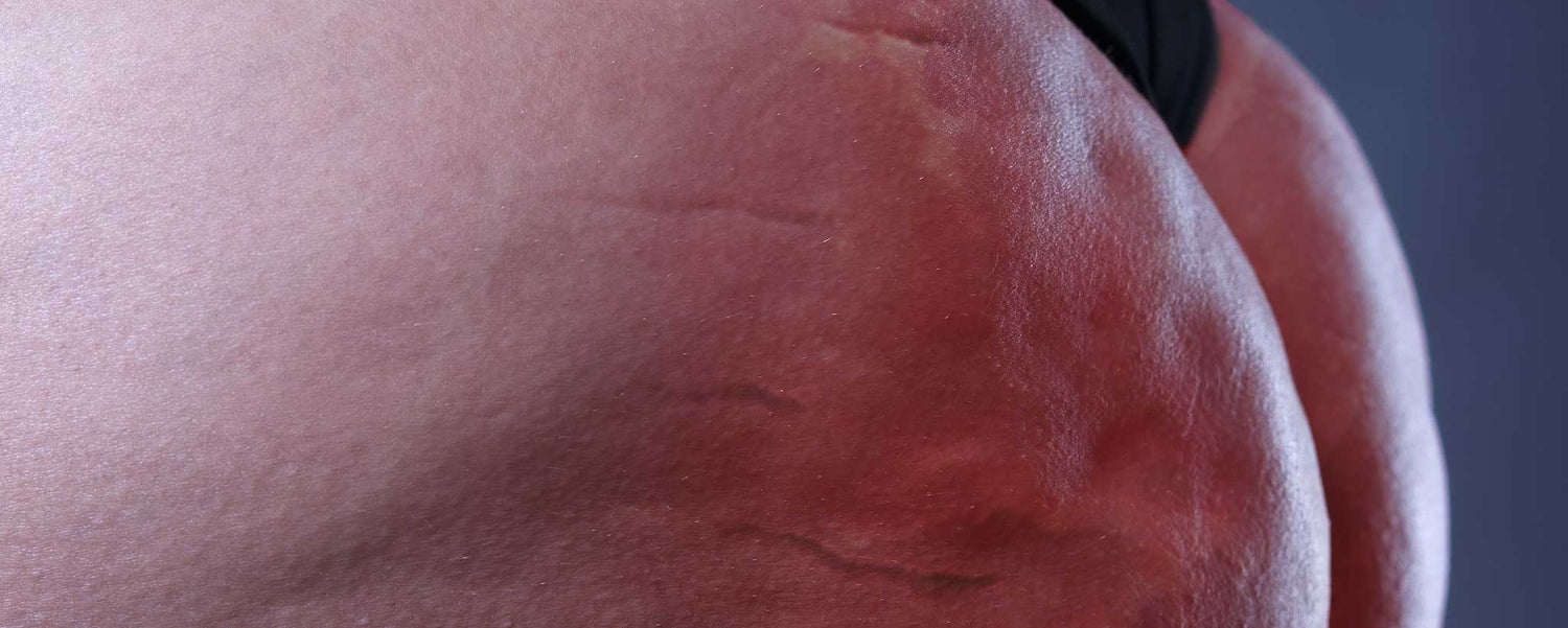 Dangers of Sedentary Jobs