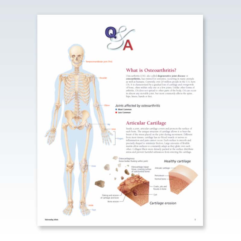 Understanding Arthritis Flip Chart Page 3