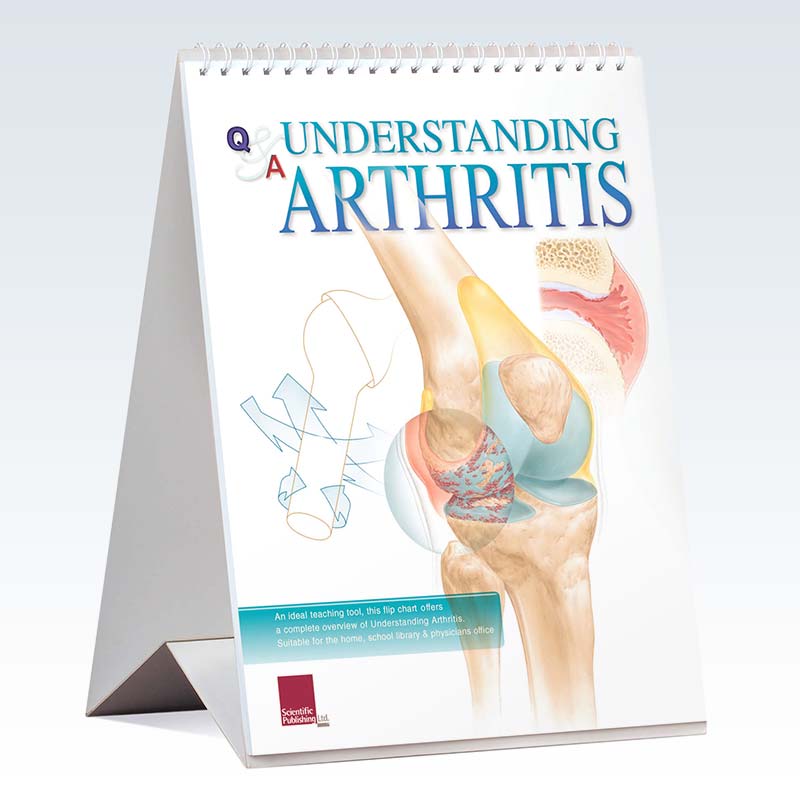 Understanding Arthritis Flip Chart