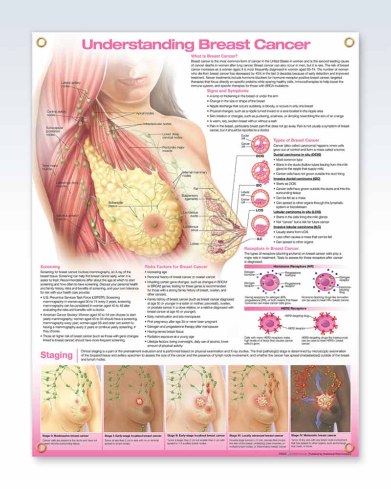 Female Breast Exam-Room Anatomy Posters