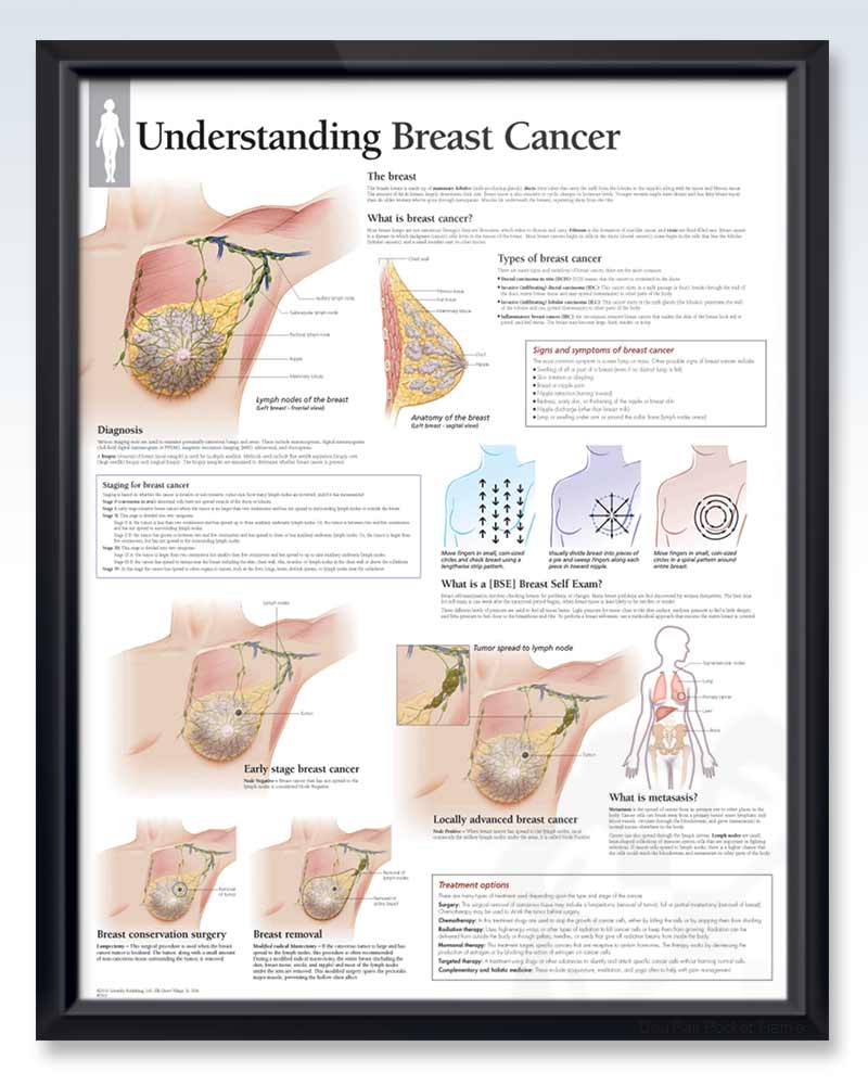 Anatomy Chart Understanding Breast Cancer 4th Edition