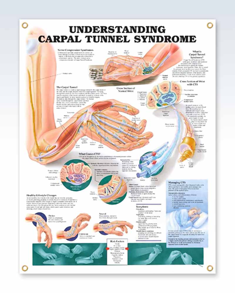 Joints Of The Upper Extremities Laminated Anatomical Chart