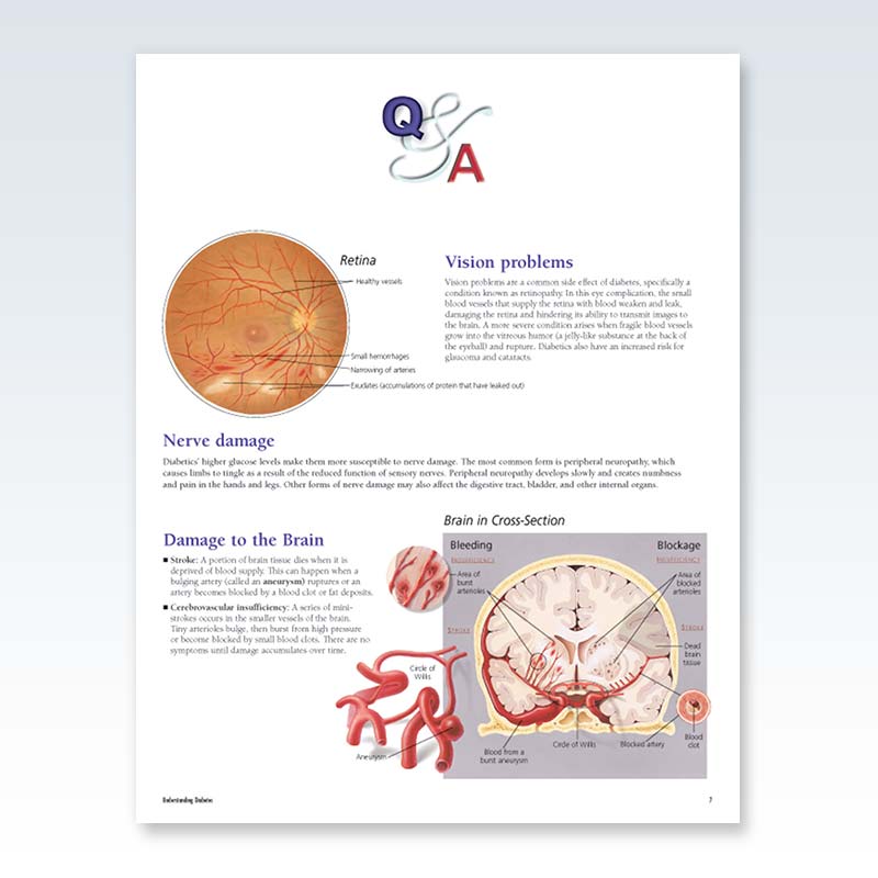 Understanding Diabetes Flip Chart Page 7