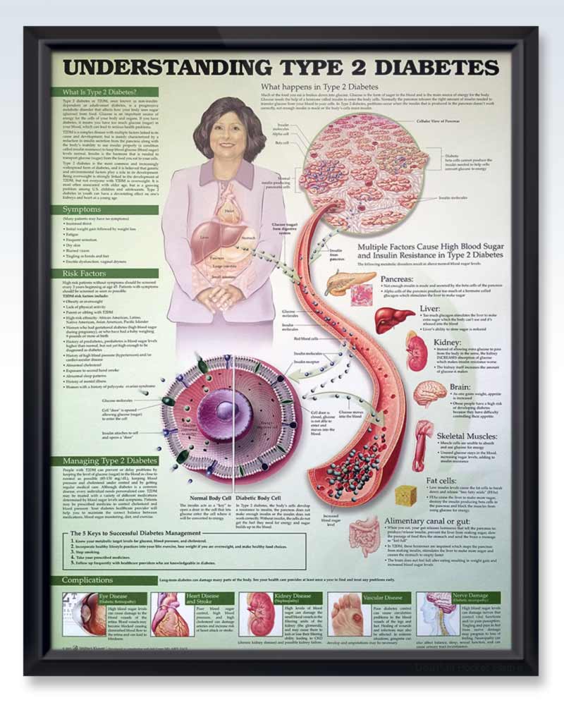 Understanding Type 20 Diabetes 20E Chart 200x206