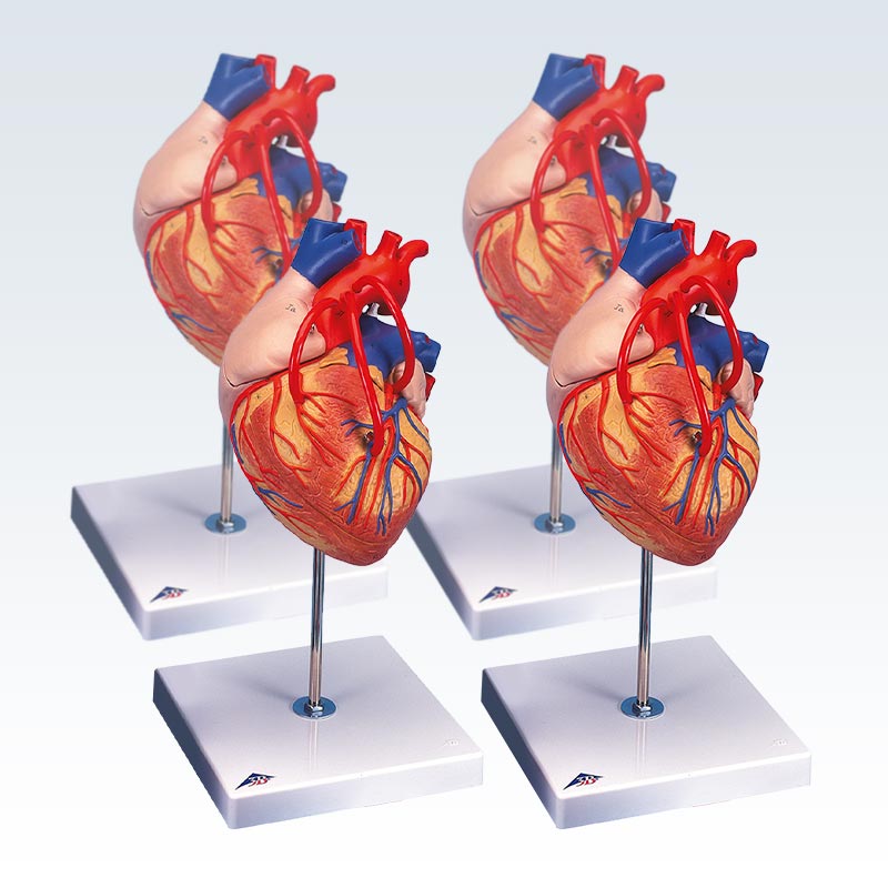 Set of 4 Heart Bypass Models