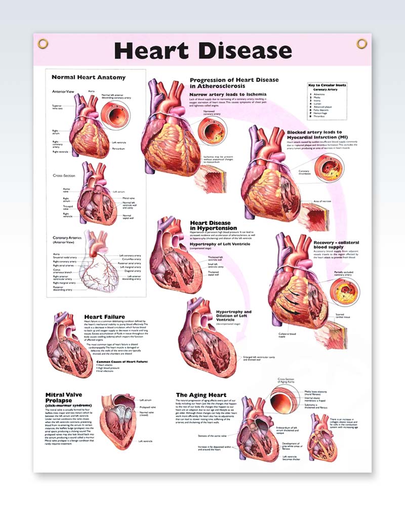Laminated Heart Disease Human Anatomy Poster ClinicalPosters