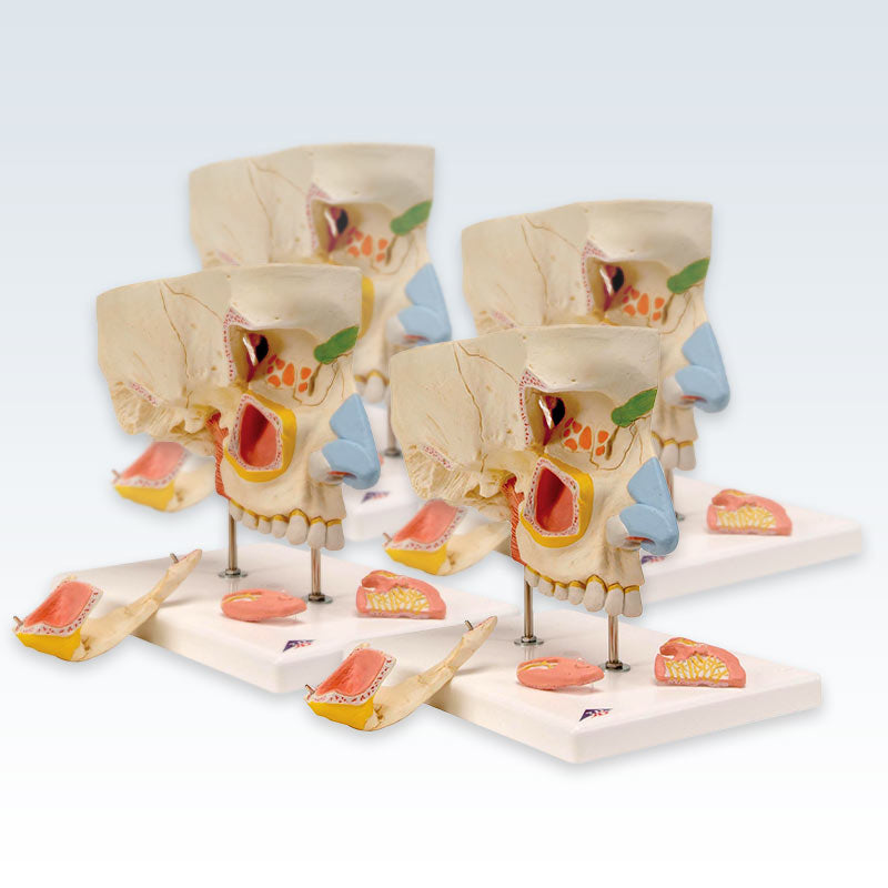 Paranasal Sinuses 5-Part Set of 4 Models