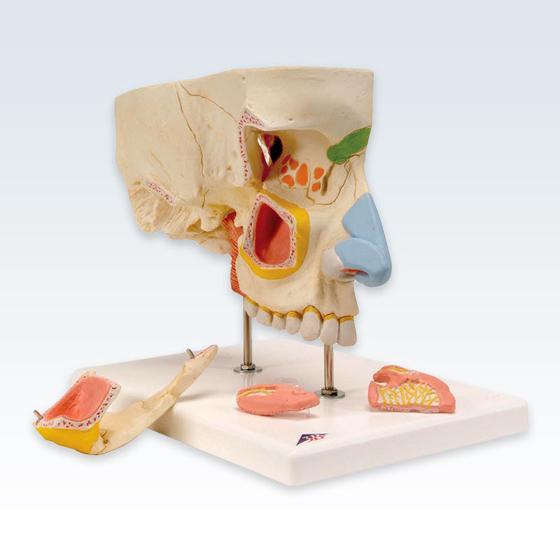 Paranasal Sinuses 5-Part Model