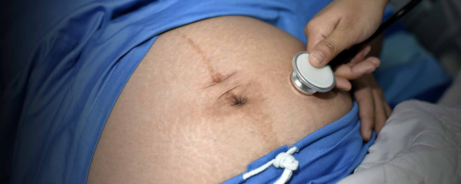 Why Cesarean Birth Rates Are So High