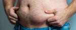 Man squeezes his flabby stomach