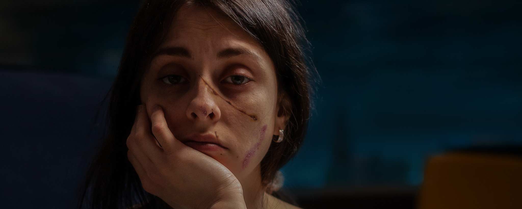 'A portrait of a scarface female in the darkness.'