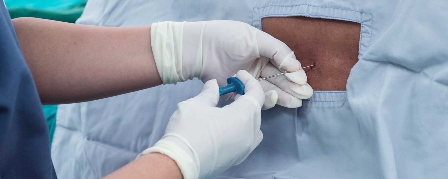 Successfully Treating Sciatic Pain