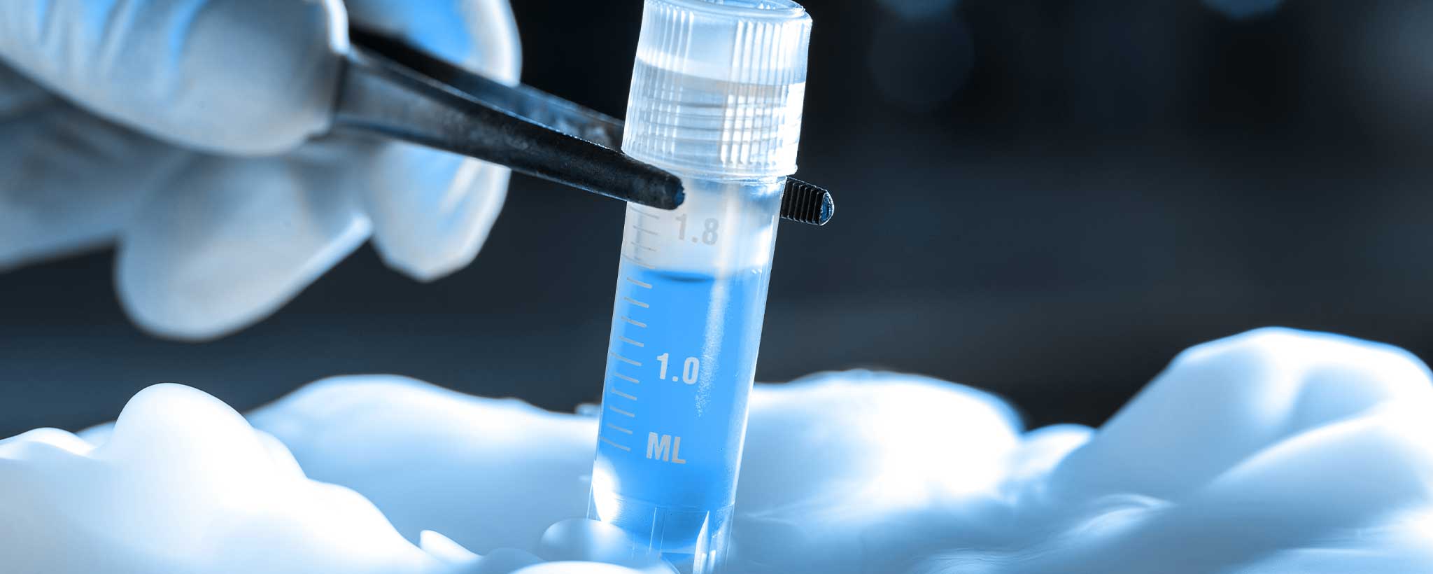 Tweezers removing IVF vial cryogenic storage