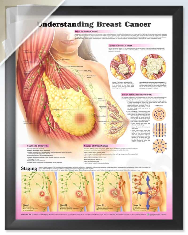 Laminated Cross Section of Female Breast Human Anatomy Educational Chart  Poster Dry Erase Sign 36x24 : : Home