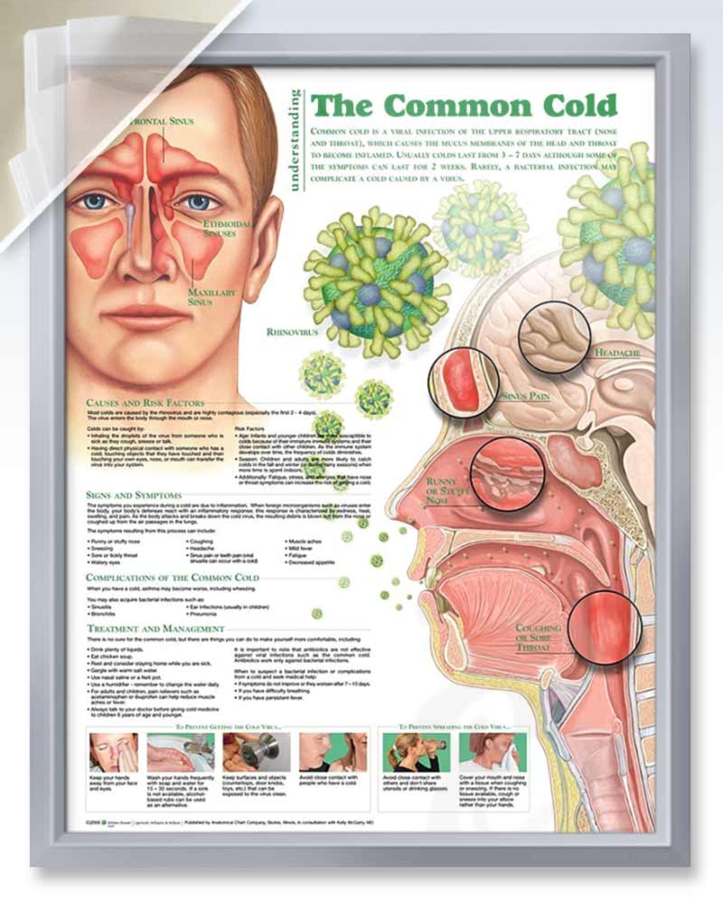 Common Cold Discount Anatomy Poster | ClinicalPosters
