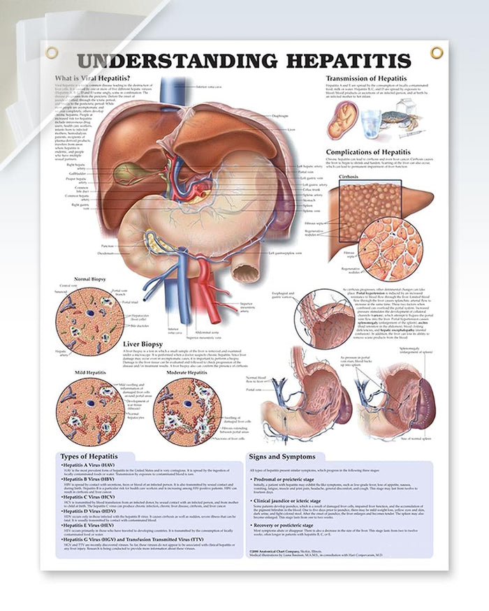 Understanding Hepatitis Discount Anatomy Poster | ClinicalPosters