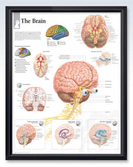 Human Brain Exam-Room Anatomy Poster | ClinicalPosters