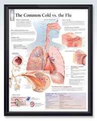 Cold vs Flu Exam-Room Anatomy Posters | ClinicalPosters