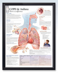 COPD & Asthma Exam-Room Anatomy Posters | ClinicalPosters