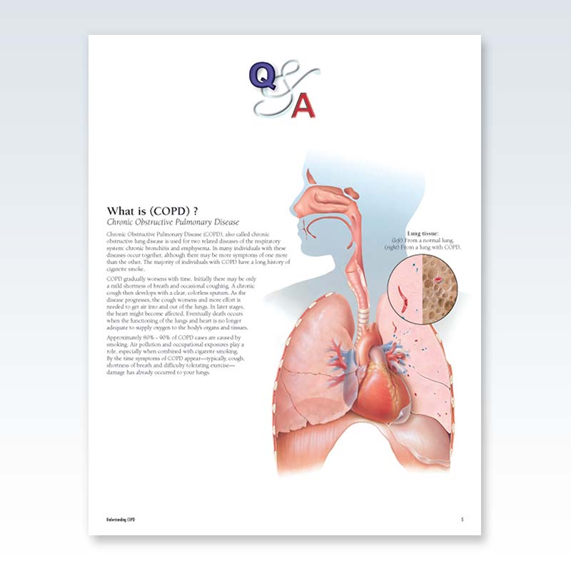Understanding COPD Flip Chart Q+A