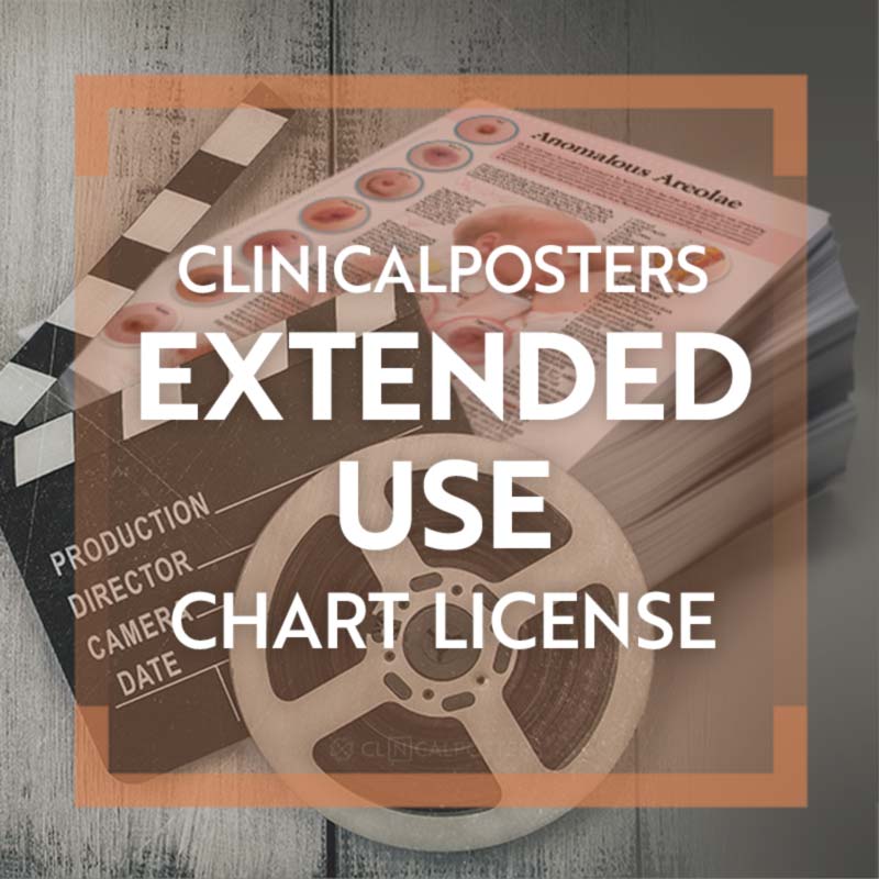 Extended-Use CP Poster License