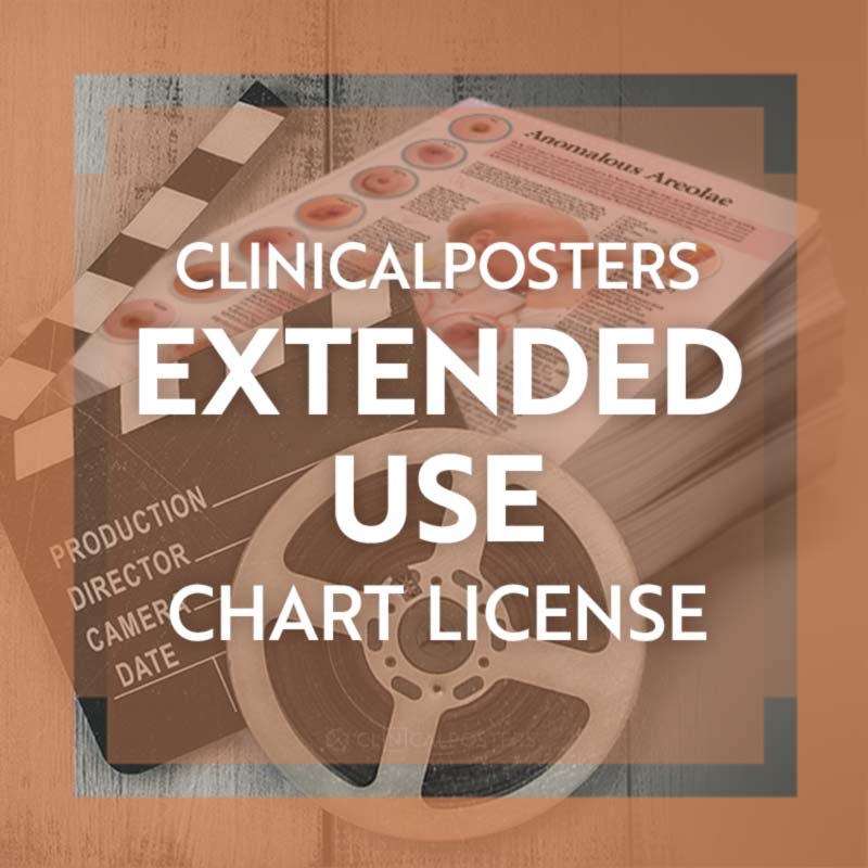 Extended-Use CP Poster License