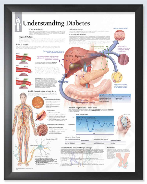 Understanding Diabetes Exam-Room Anatomy Poster | ClinicalPosters