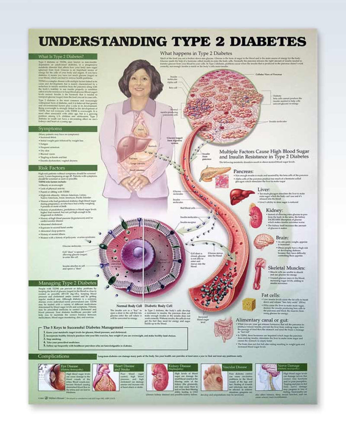 Type 2 Diabetes Exam-Room Human Anatomy Posters | ClinicalPosters