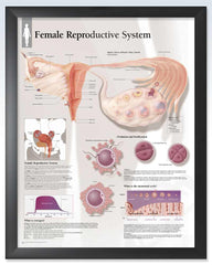 Female Reproductive System Exam-Room Anatomy Poster | ClinicalPosters