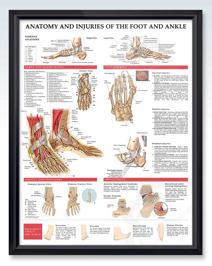 Foot Injuries Types Podiatrists Anatomical Medical Posters and Models | ClinicalPosters