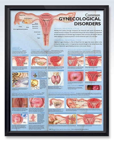 Obstetrics and Gynecology Medical Anatomy Posters – ClinicalPosters