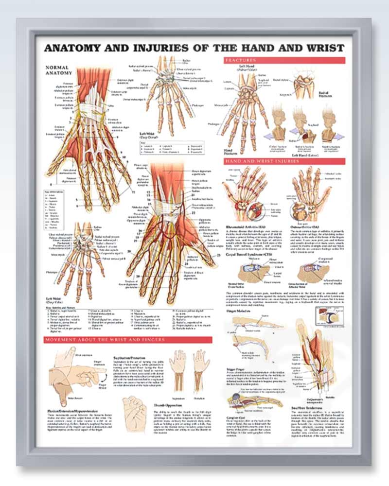hand injury poster