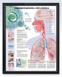 Influenza Exam-room Human Anatomy Posters 