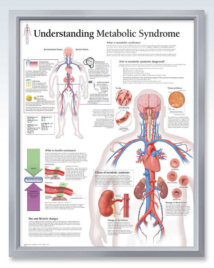 Metabolic Syndrome Exam-Room Anatomy Poster | ClinicalPosters