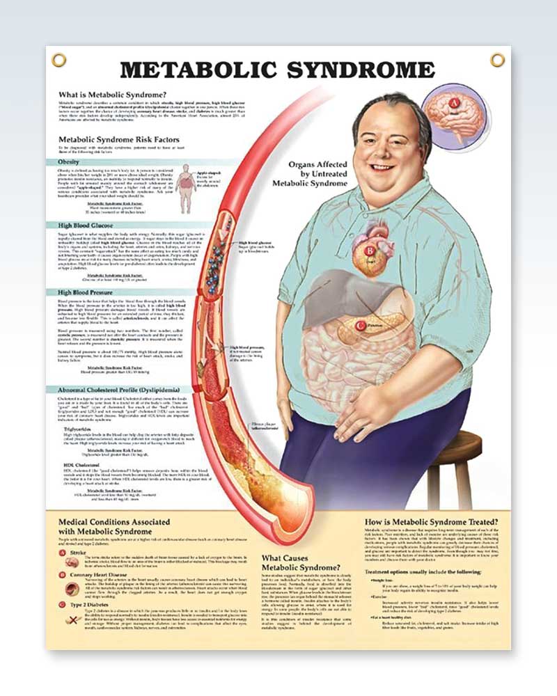 Metabolic Syndrome Chart 20x26