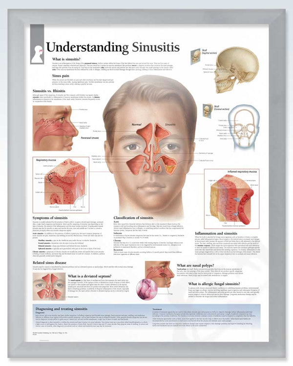 Understanding Sinusitis Exam-Room Human Anatomy Poster