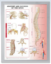 Injuries of the Spine Exam Room Anatomy Posters – ClinicalPosters