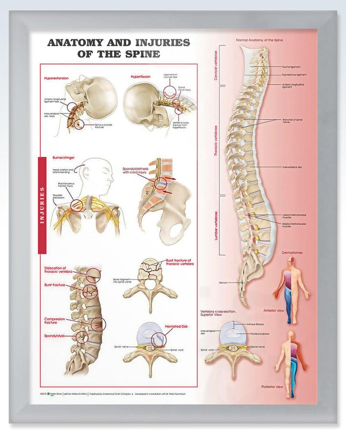 Injuries Of The Spine Exam Room Anatomy Posters – Clinicalposters