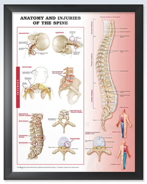 Injuries of the Spine Exam Room Anatomy Posters – ClinicalPosters