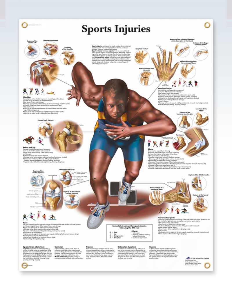 Sports Injuries Exam Room Poster | ClinicalPosters