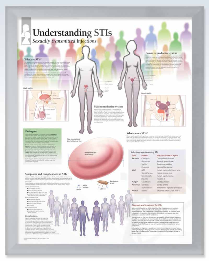 Sti Inection Understanding Sexually Transmitted Infections Anatomy Poster