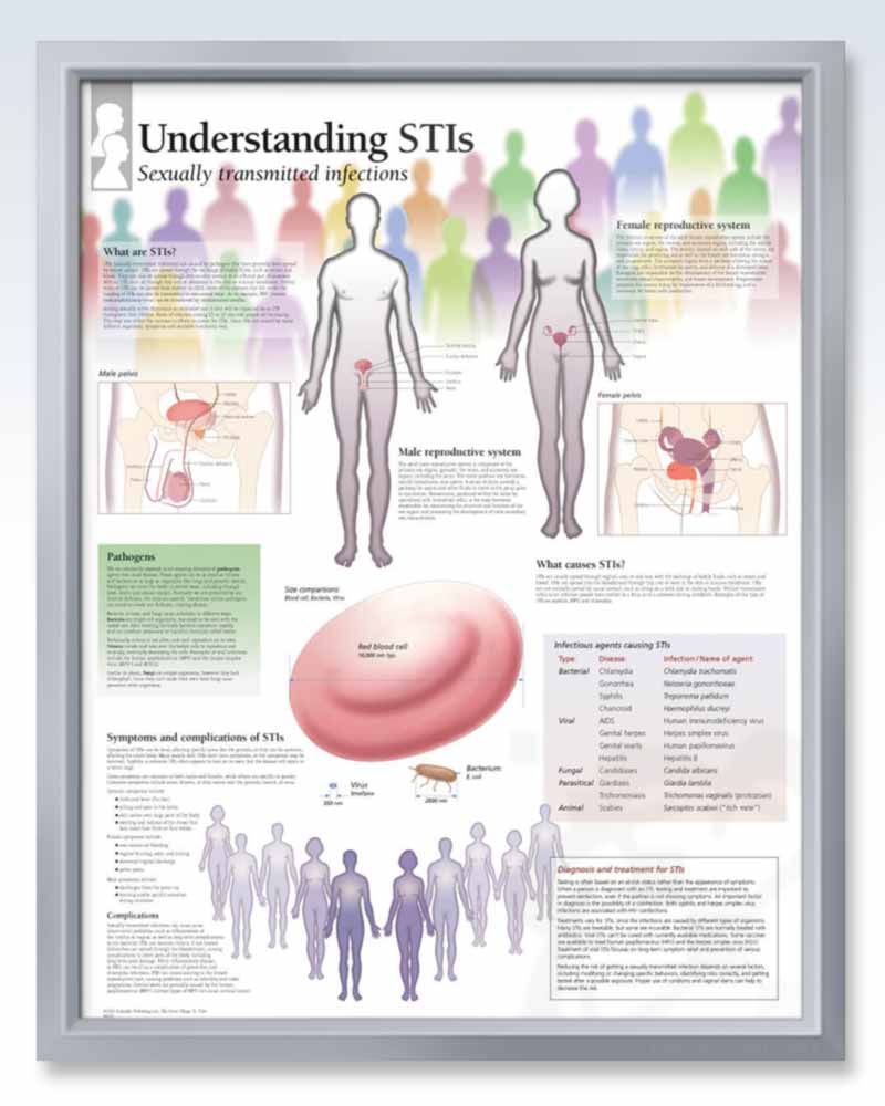 Sti Information.pdf Understanding Sexually Transmitted Infections Anatomy Poster