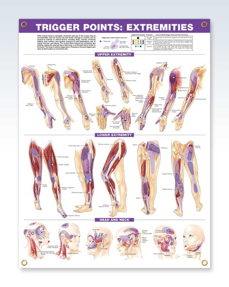 Laminated Trigger Points Set Anatomy Posters | ClinicalPosters