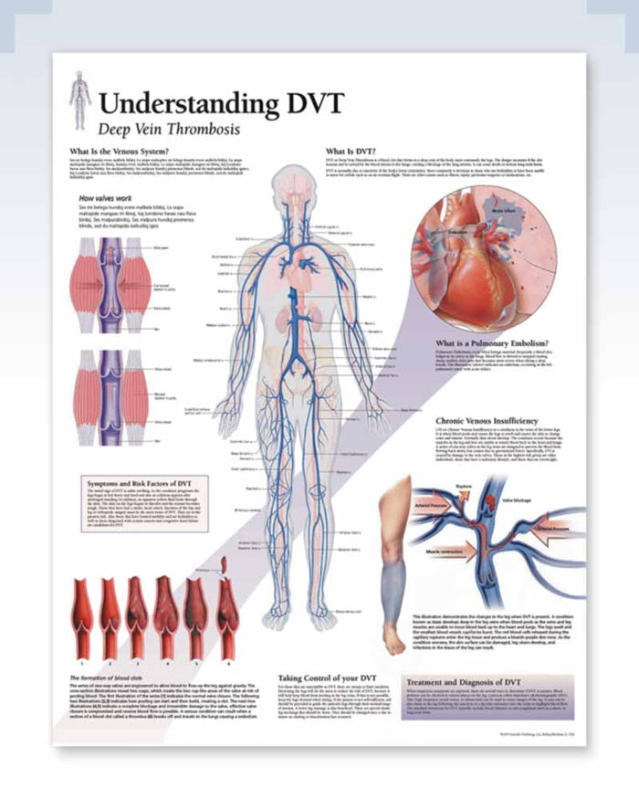 Dvt Vision Understanding DVT Exam-Room Anatomy Poster | ClinicalPosters